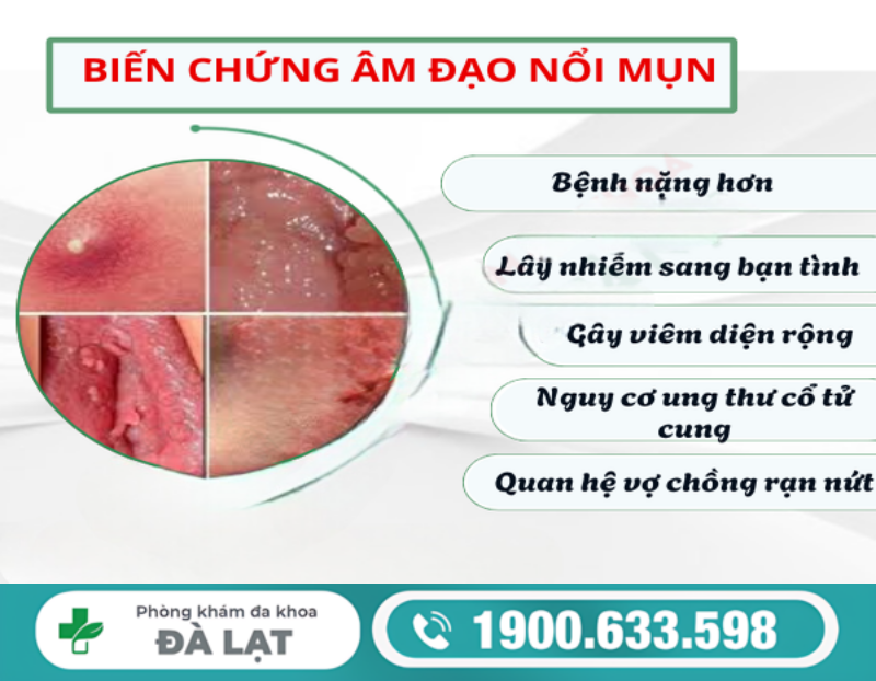Hình ảnh minh họa